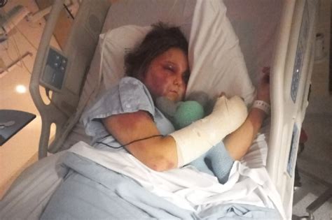 kirra hart interview|Teenage victim of savage Queensland beating speaks ...